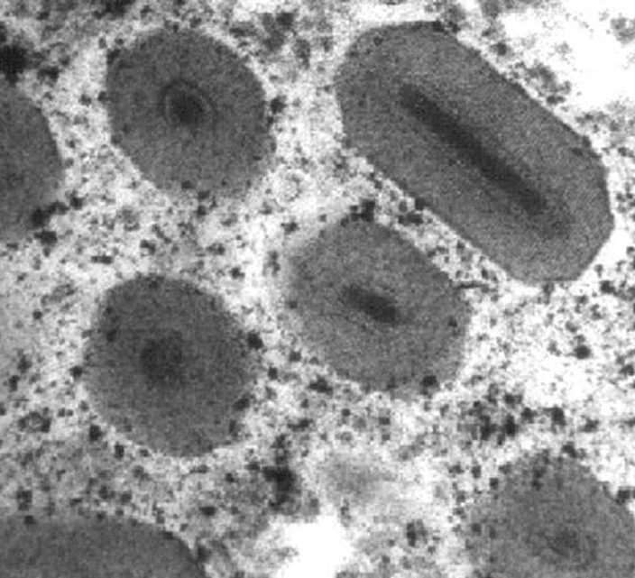 Vue au microscope de virus de la granulose du carpocapse, alias CpGV. Photo : D. Winstanley - Andermatt Biocontrol